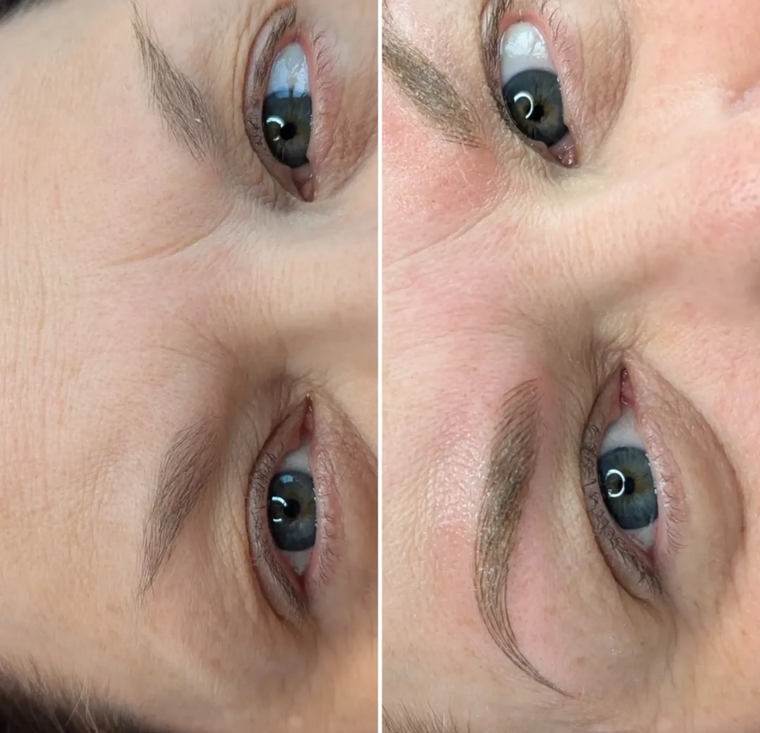 cosmetic tattoo correction Brisbane