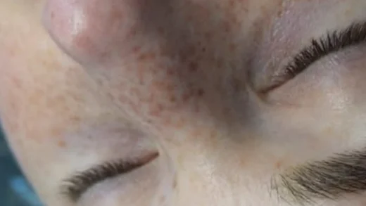 nano combination brows Melbourne